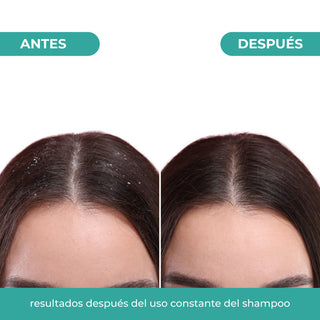 Shampoo Control Caspa 300ml